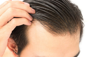 close up on thin hair of a man